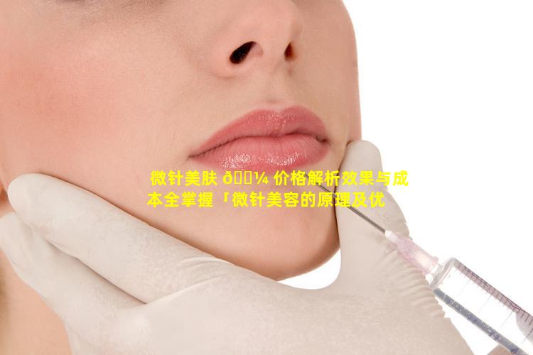 微针美肤 🐼 价格解析效果与成本全掌握「微针美容的原理及优 🌴 缺点」